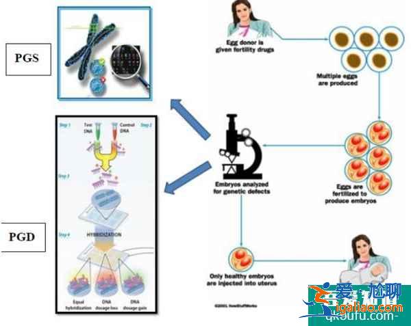 试管婴儿成功率高、安全性有保障深受大家推崇？