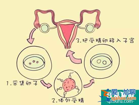 如何配合医生进行试管婴儿技术治疗？？