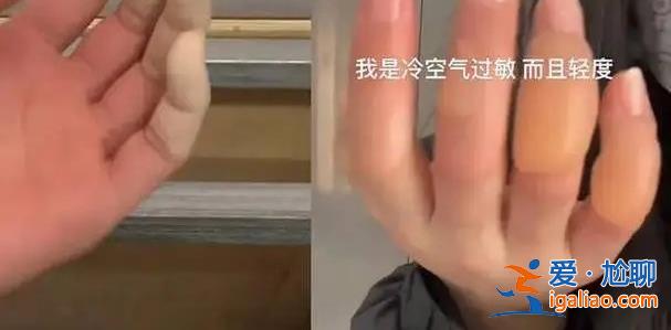 女孩为何零下18度户外光手跑步 女孩被截肢了吗？